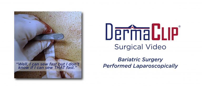 DermaClip closure of laparoscopic surgery